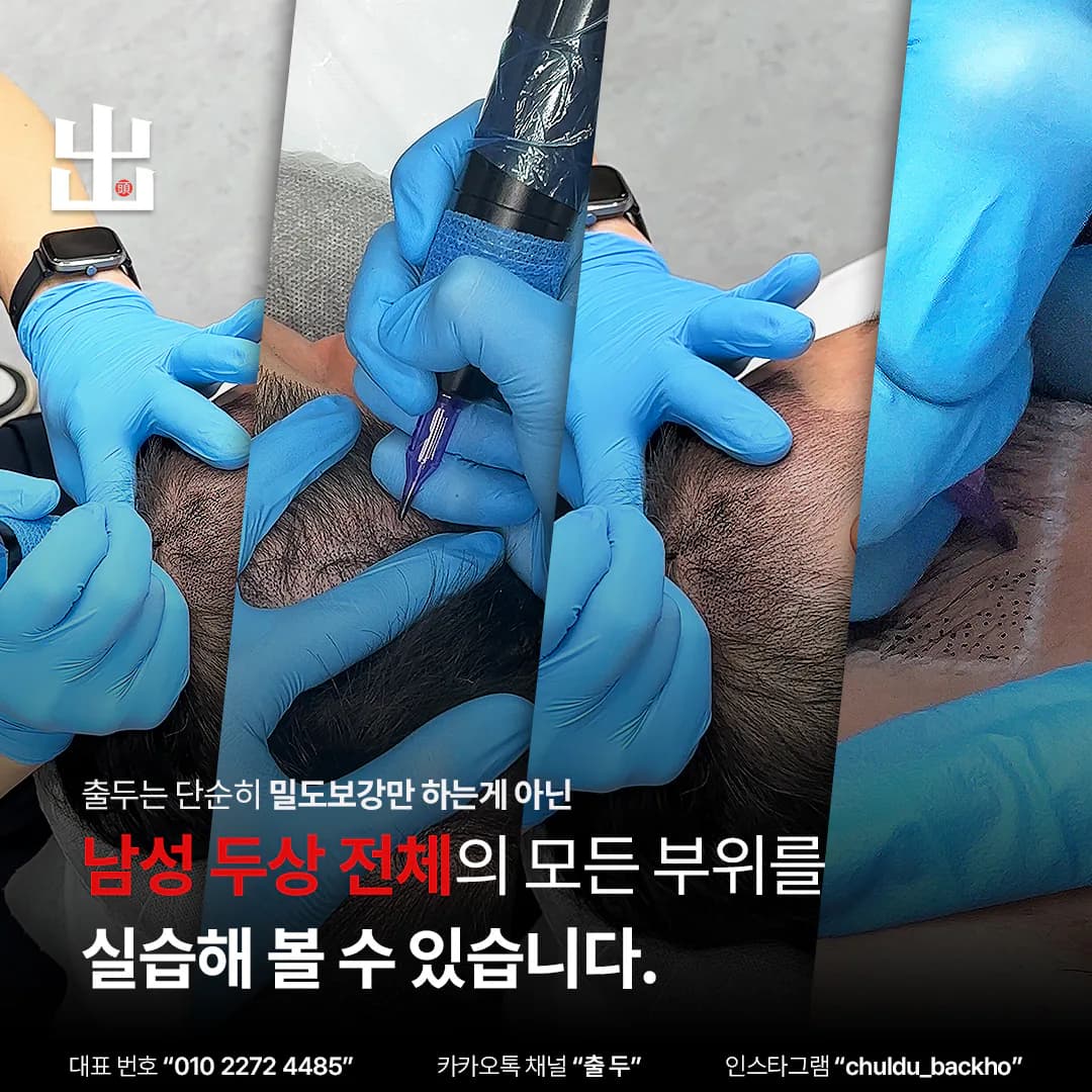 두상 부위별 두피문신 실습 범위를 보여주는 클로즈업 사진