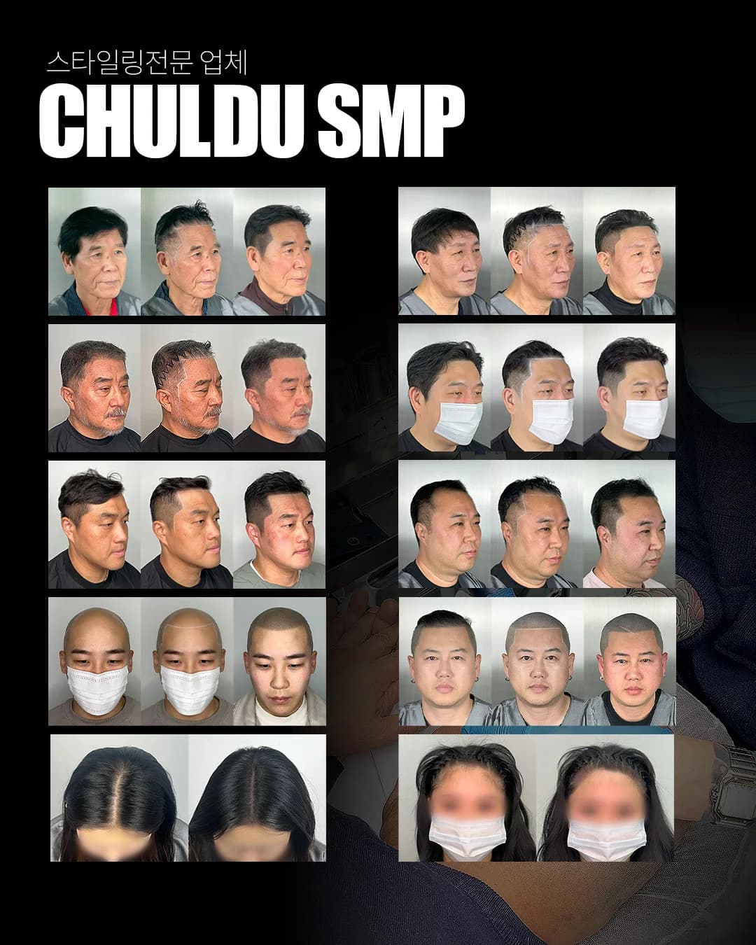남성·여성 고객 열 명의 두피문신 시술 전·디자인·후 3컷 비교 모음