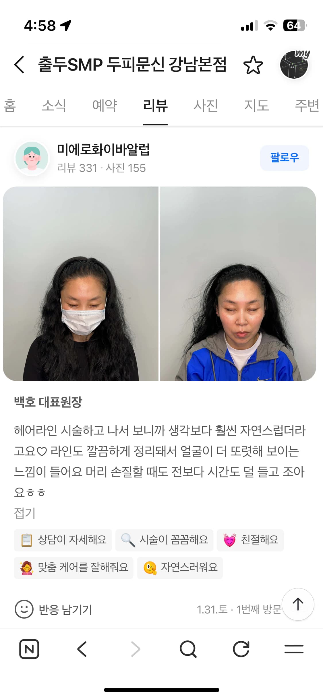 네이버 플레이스 리뷰 캡처 — 여성 헤어라인 두피문신 시술 전후 사진과 후기