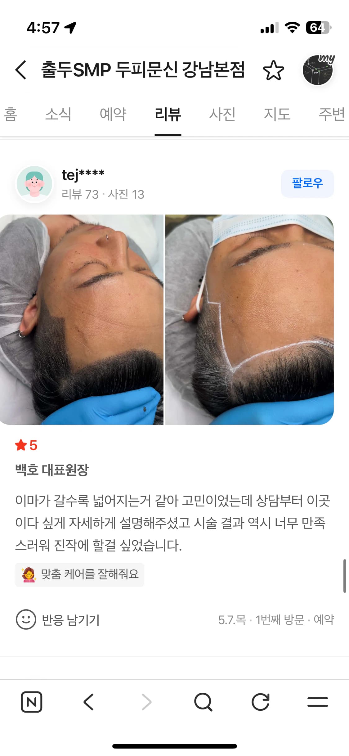 네이버 플레이스 리뷰 캡처 — 이마 헤어라인 두피문신 시술 전후 사진과 후기