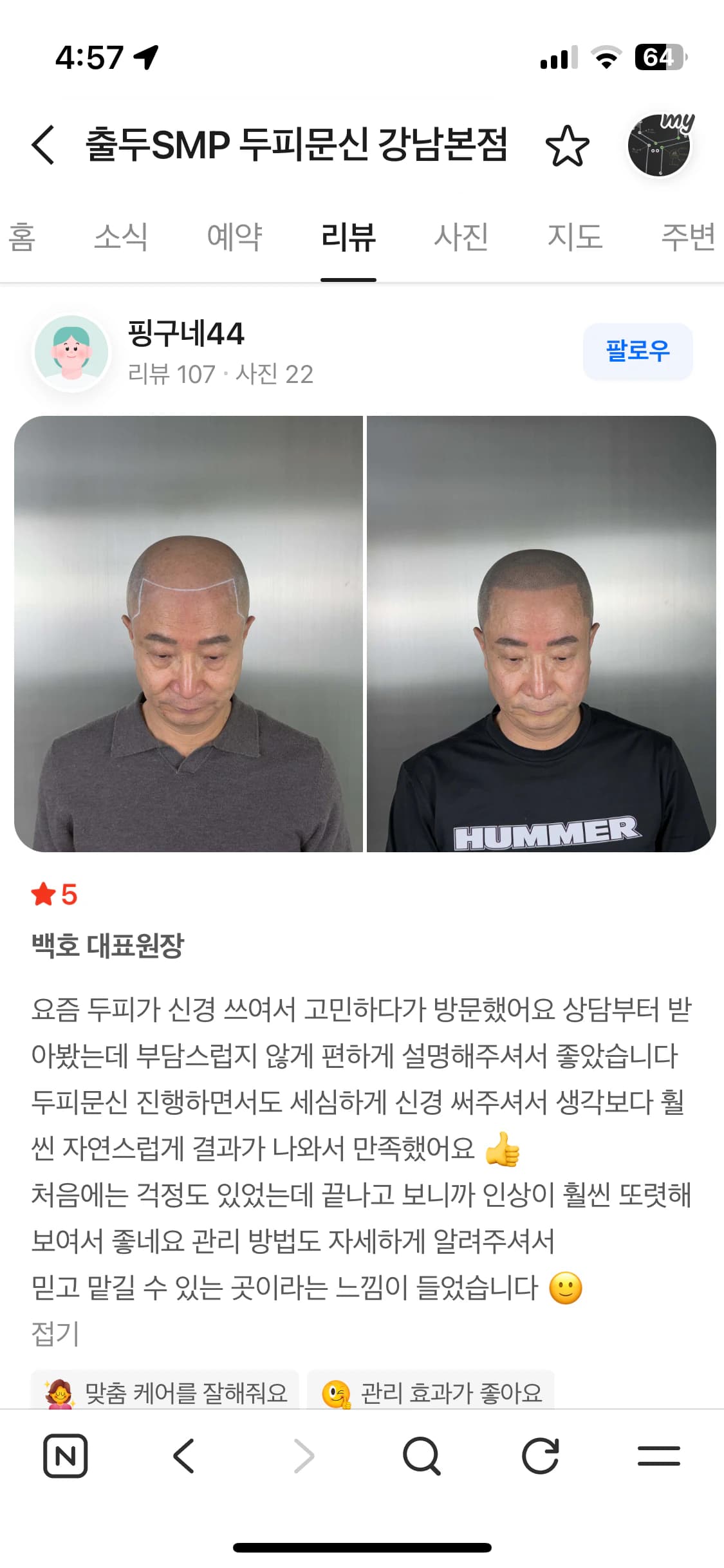 네이버 플레이스 리뷰 캡처 — 남성 헤어라인 두피문신 시술 전후 사진과 후기