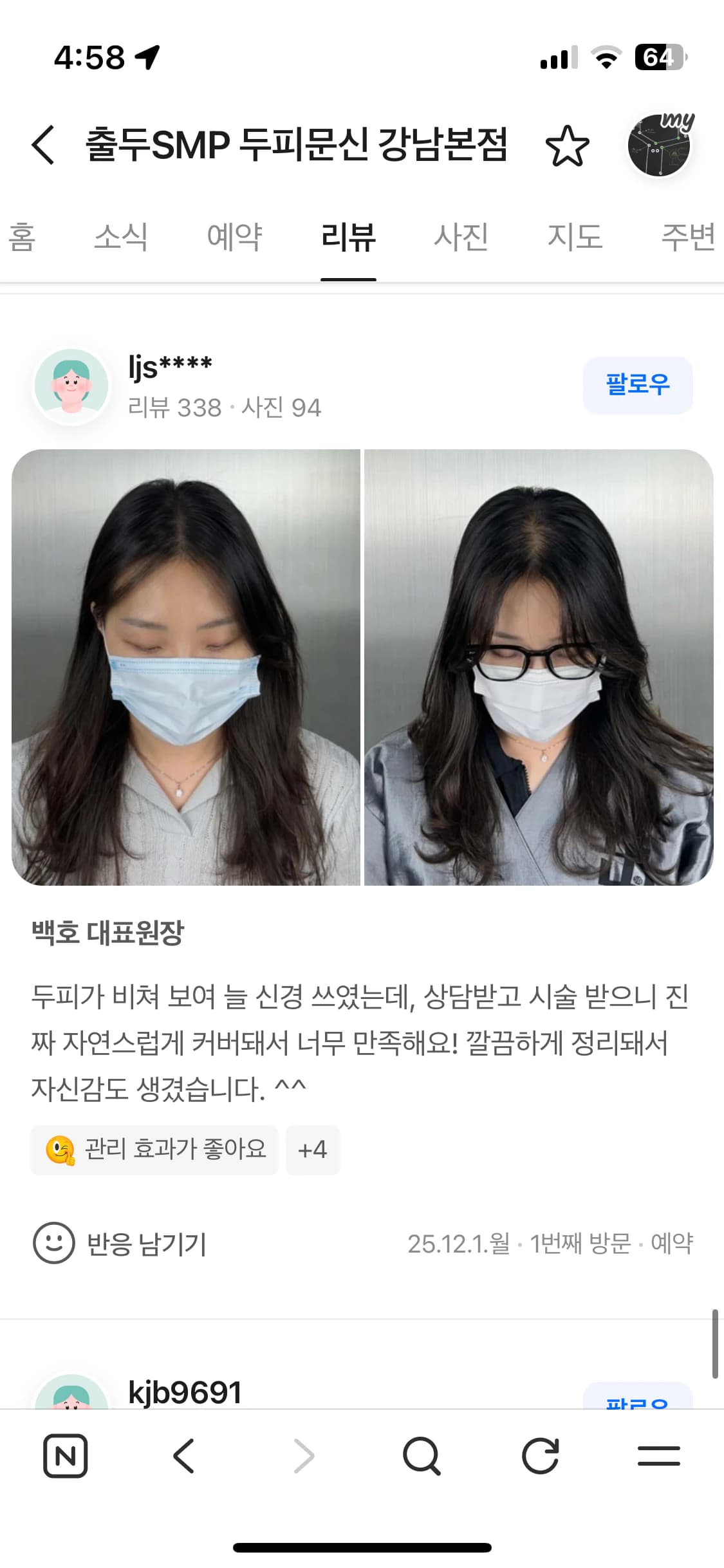 네이버 플레이스 리뷰 캡처 — 여성 두피 커버 두피문신 시술 전후 사진과 후기