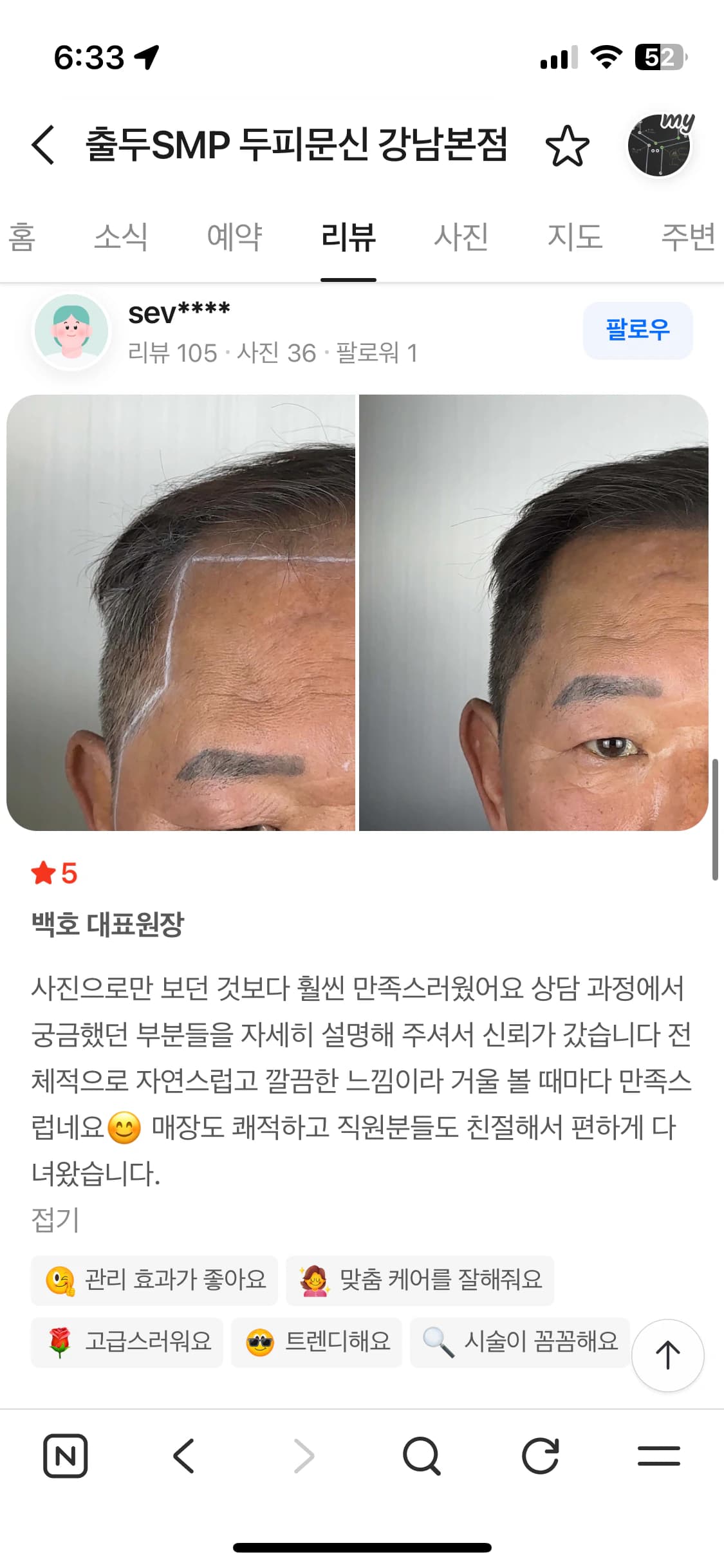 네이버 플레이스 리뷰 캡처 — 남성 헤어라인 측면 두피문신 시술 전후 사진과 후기