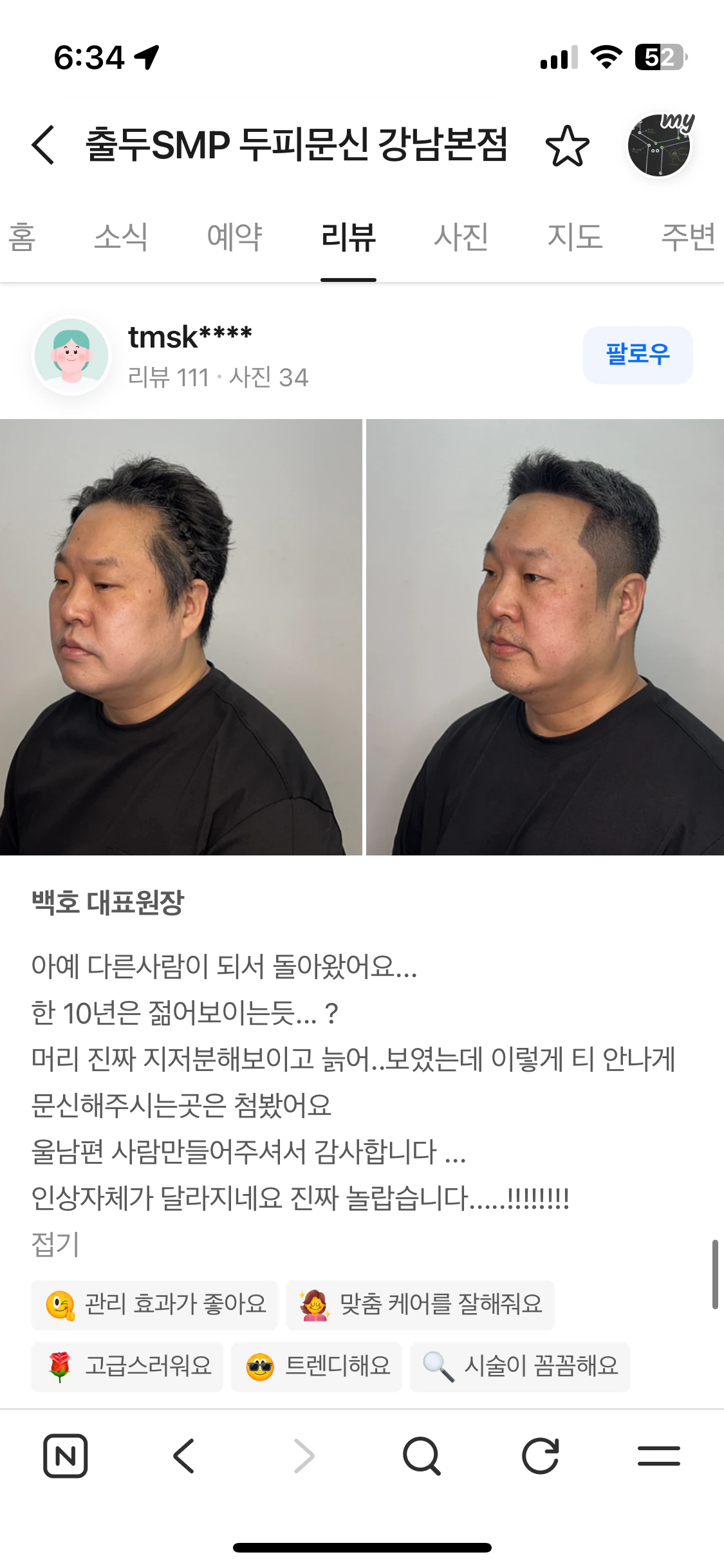 네이버 플레이스 리뷰 캡처 — 남성 헤어라인 두피문신 시술 전후 측면 사진과 후기