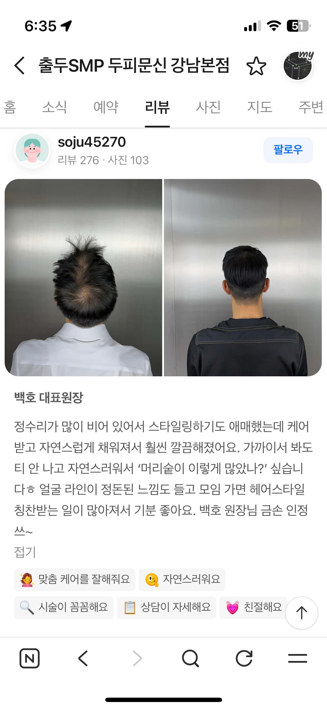 네이버 플레이스 리뷰 캡처 — 남성 정수리 두피문신 시술 전후 뒷모습 사진과 후기