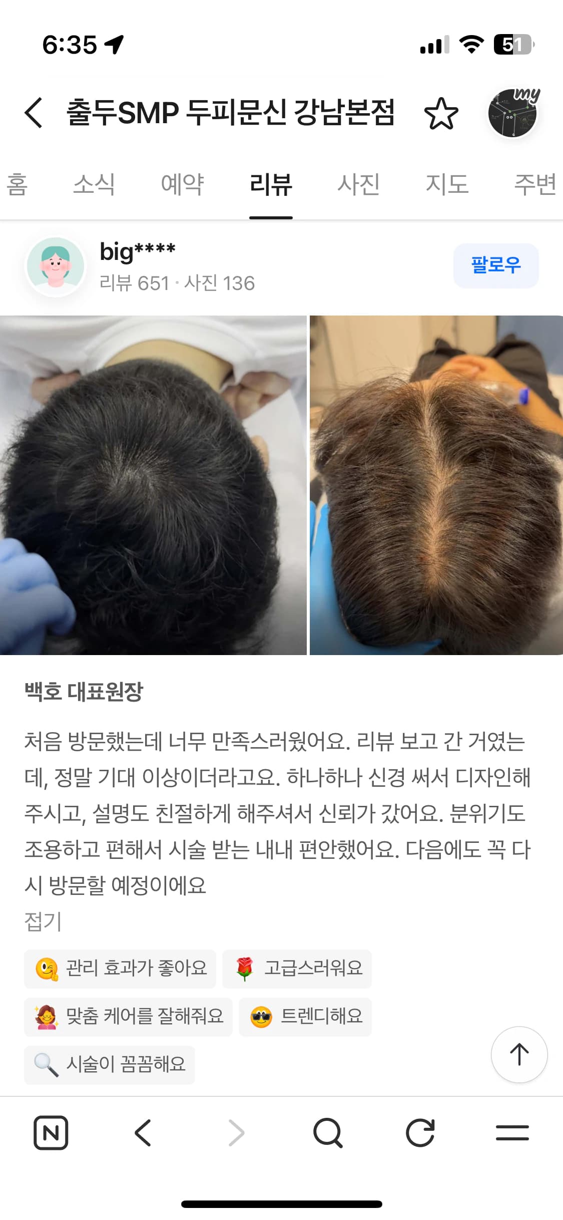 네이버 플레이스 리뷰 캡처 — 정수리 두피문신 시술 전후 윗머리 사진과 후기